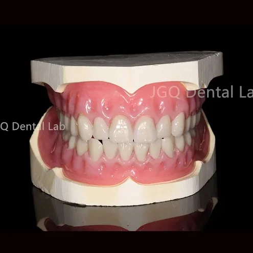 Chin Denture Master Lab 1 chin denture master lab