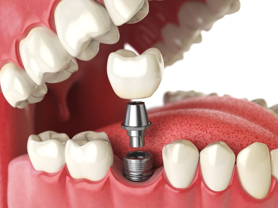 Dgigi Dental 1 dgigi dental