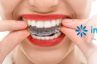 Icon Dental โข Sri Petaling โข Invisalign Diamond Provider โข Veneers โข Implants โข Braces 1 icon dental sri petaling invisalign diamond provider veneers implants braces