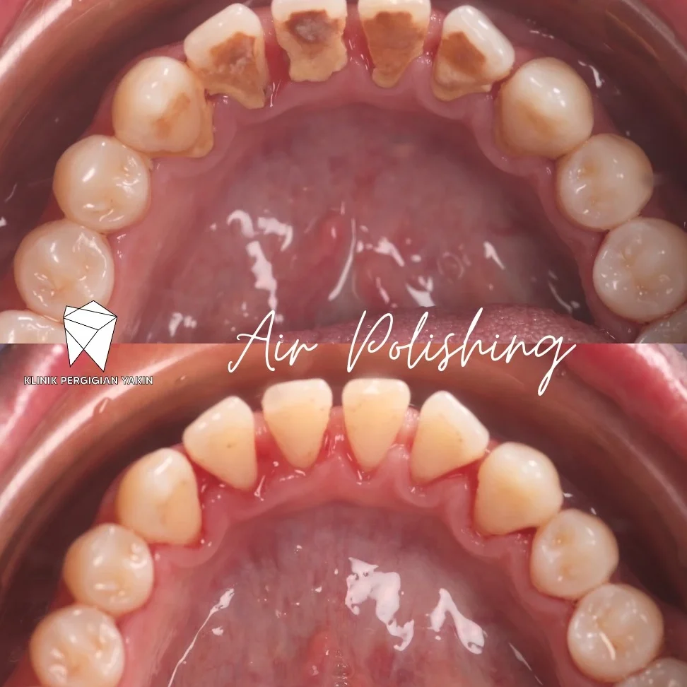 klinik gigi terbaik di bemban