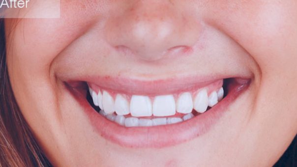 klinik gigi terbaik di raub