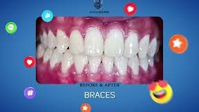 klinik pergigian dental legacy larkin braces clear aligner veneer and whitening
