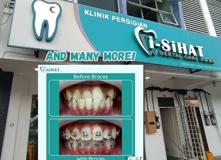 Klinik Pergigian I-Sihat (Pasir Gudang) 1 klinik pergigian i sihat pasir gudang