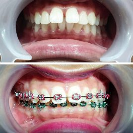 Klinik Pergigian LD | LD Dental Clinic @ Banting 1 klinik pergigian ld ld dental clinic banting