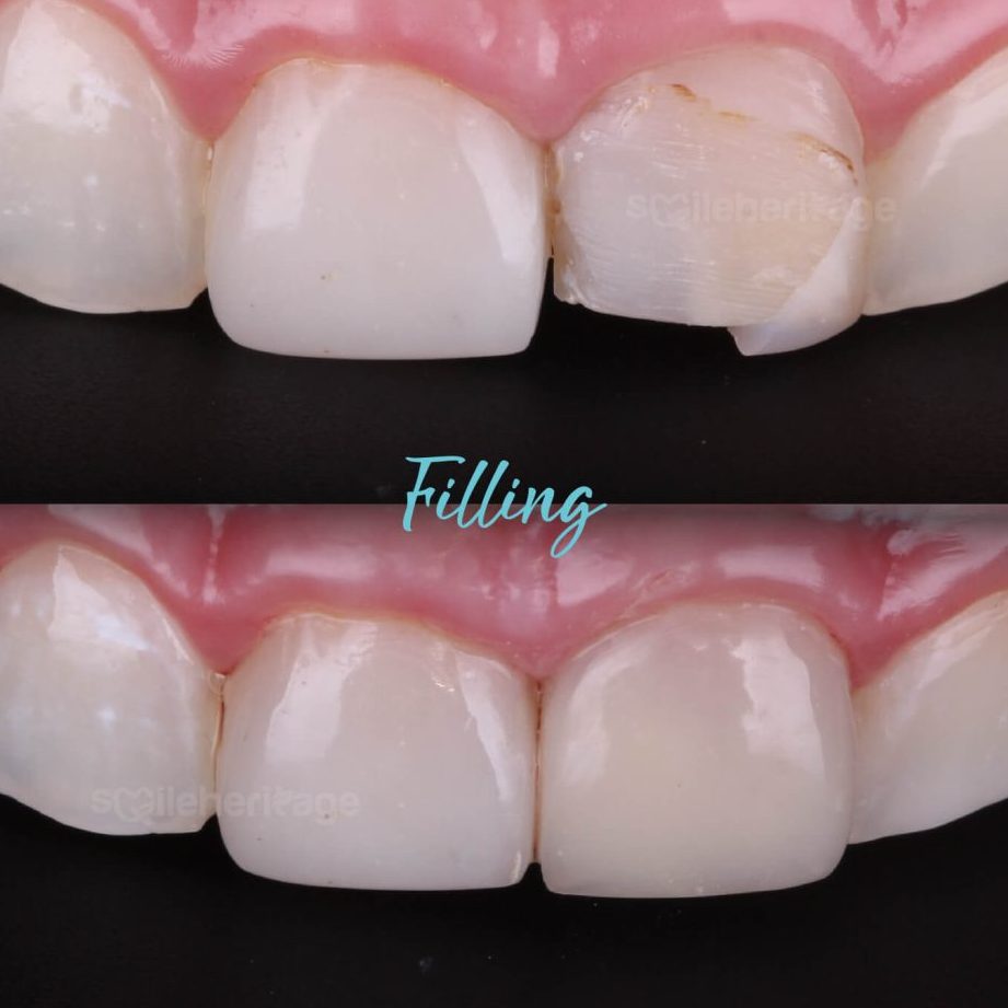 klinik pergigian smile heritage cosmetic dentist pasir gudang